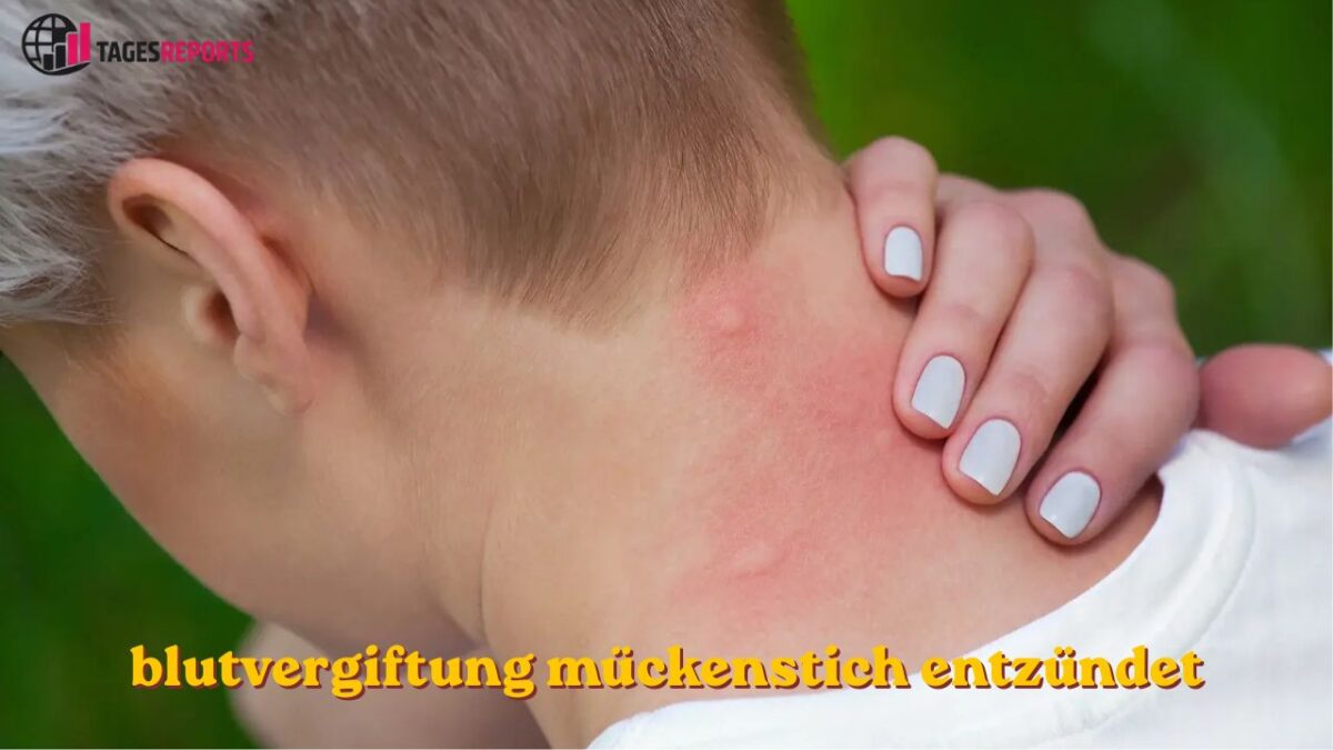blutvergiftung mückenstich entzündet