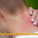 blutvergiftung mückenstich entzündet