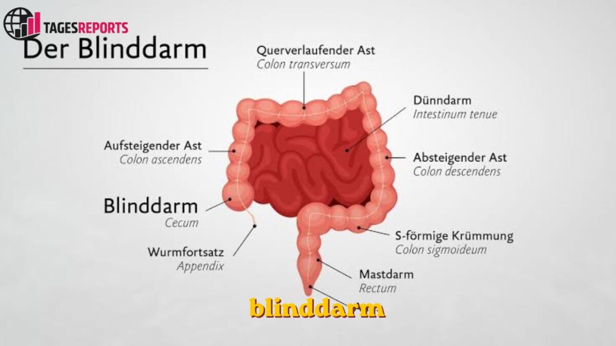 blinddarm