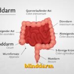 blinddarm