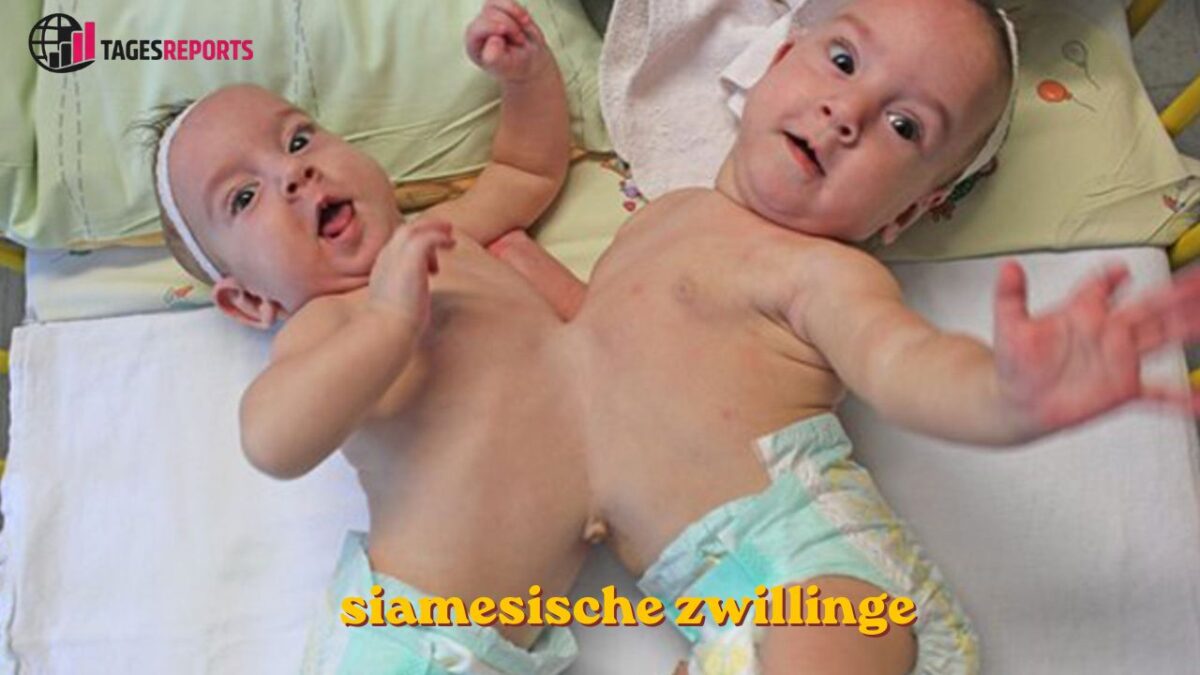 Siamesische Zwillinge Siamesische Zwillinge
